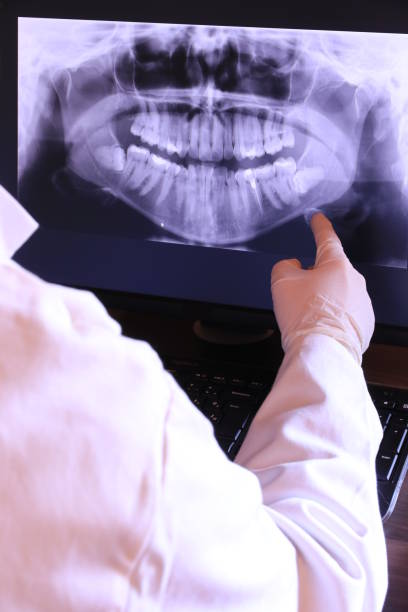 Best Knocked-Out Tooth (Avulsed Tooth) Treatment in Ashley, PA